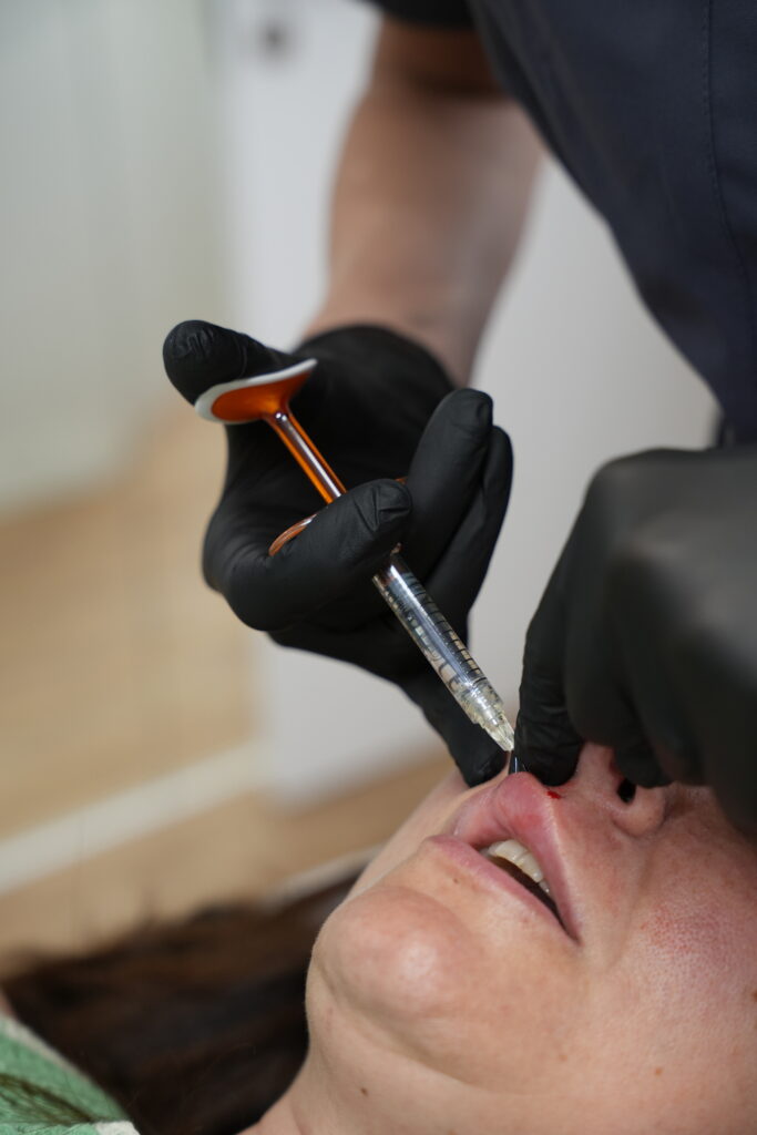 Primer plano de labios hidratados y proporcionados con un resultado natural