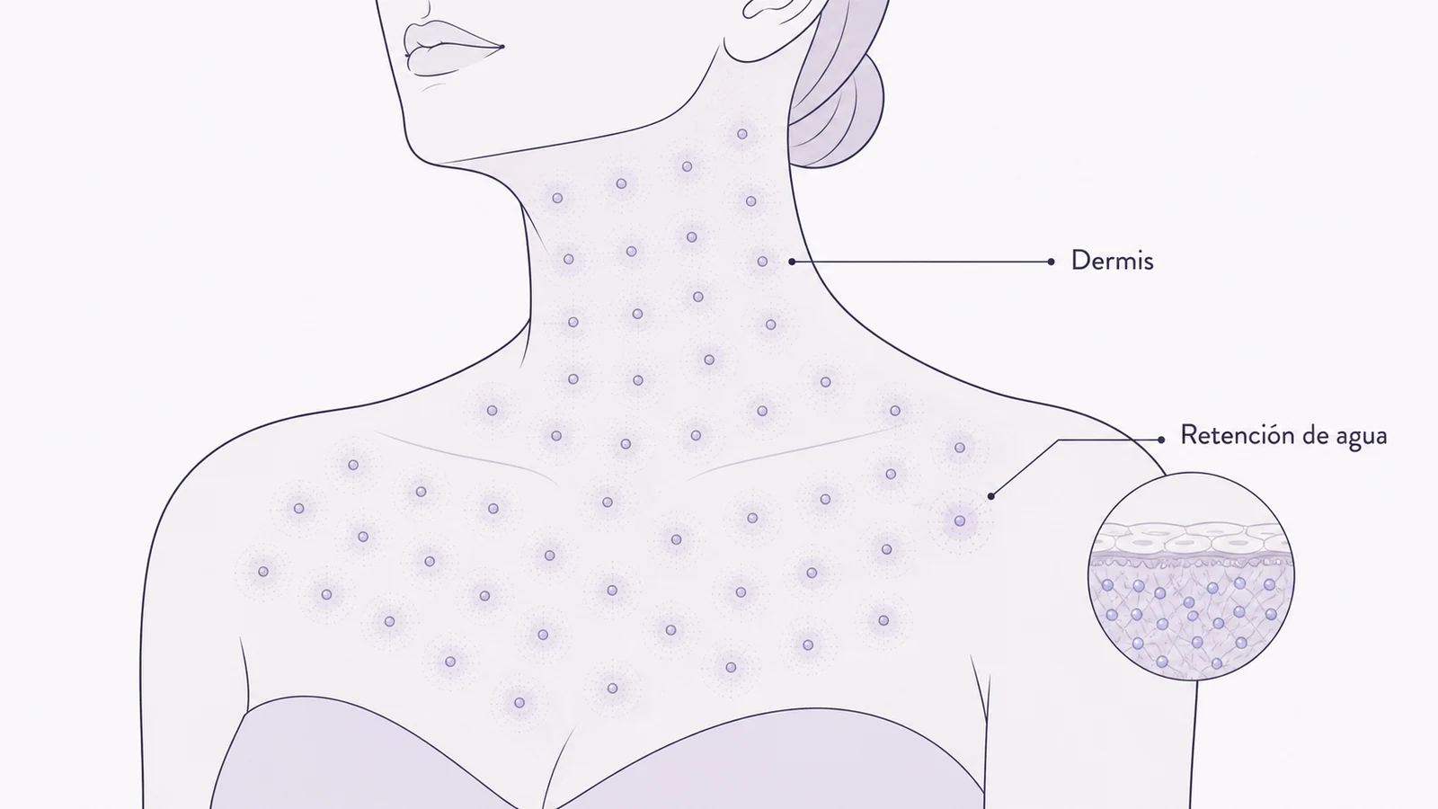 Ilustración médica sobre microinyecciones distribuidas en cuello y escote en rejuvenecimiento de cuello y escote